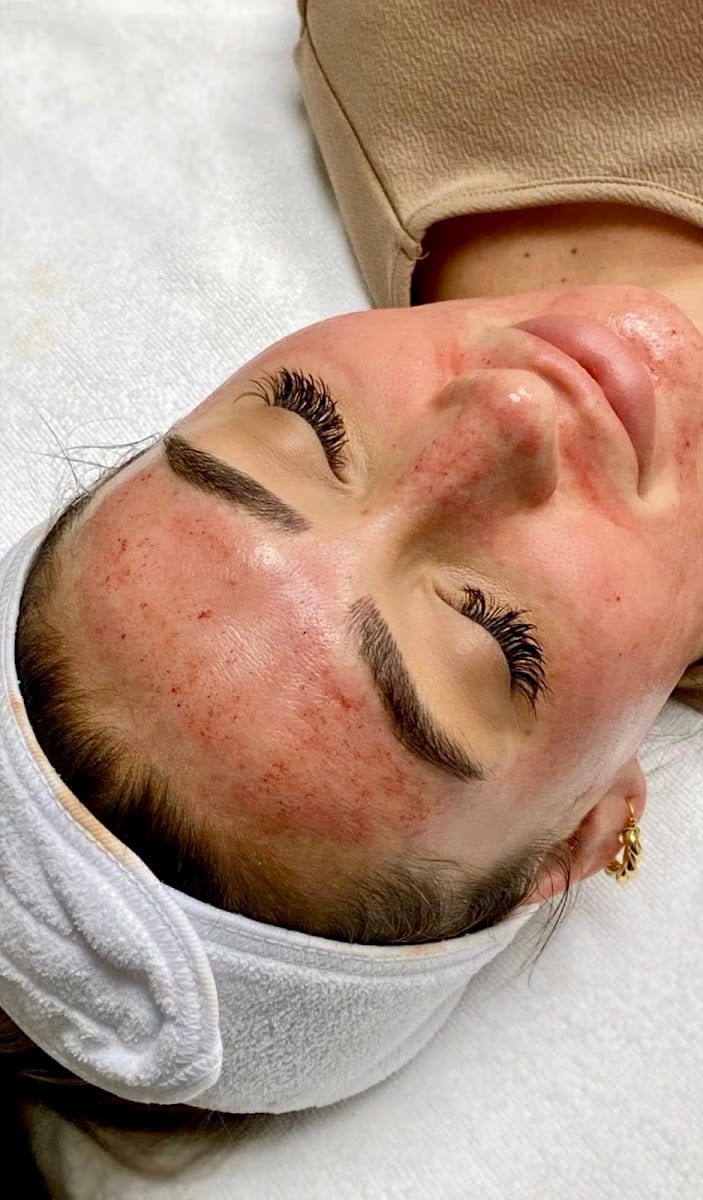 Lavish Skin, photo 3