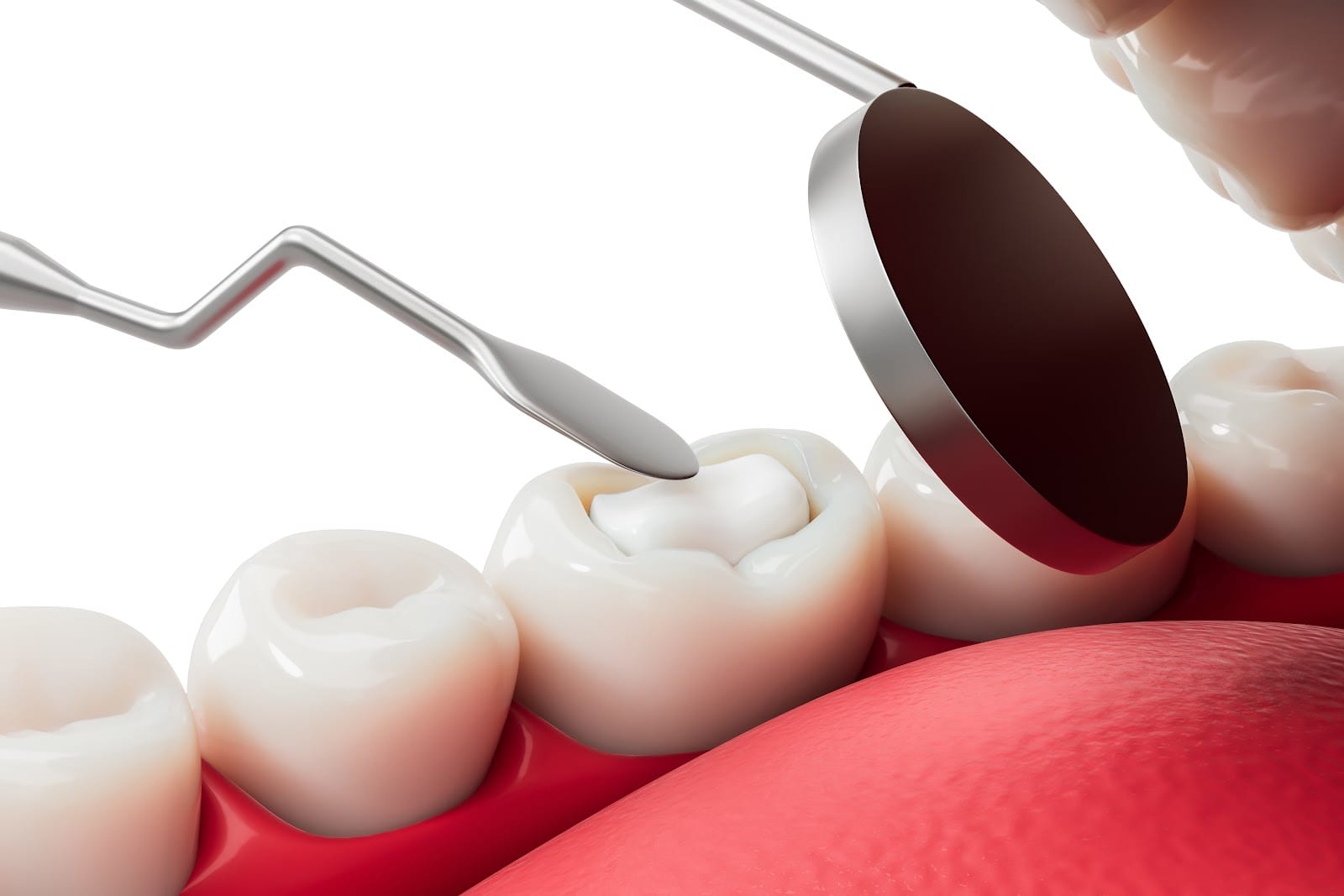 Muccioli Dental, photo 2