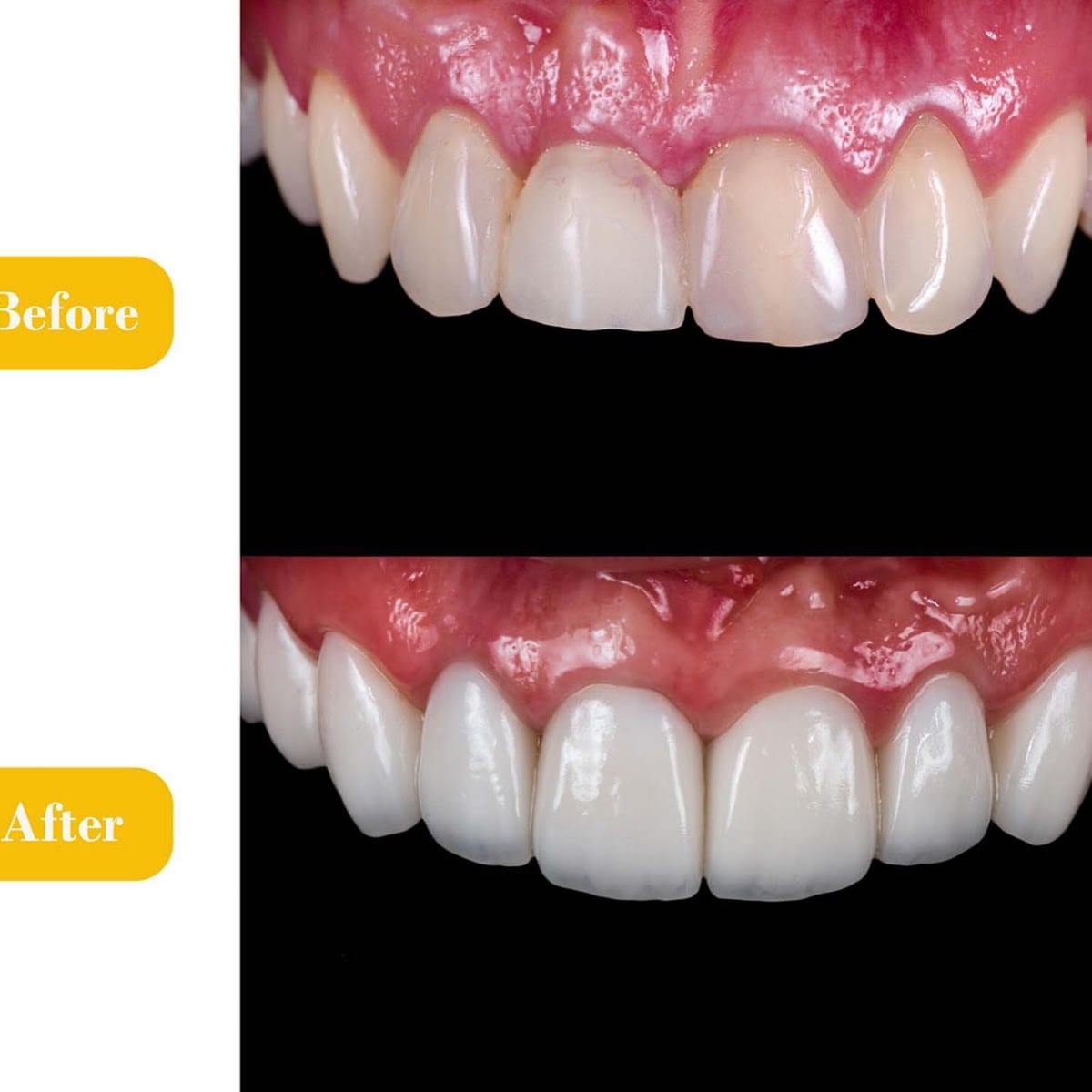 Crystal Dentistry