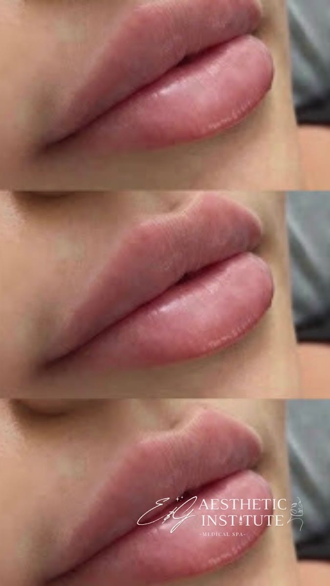 E&G Aesthetic Institute - Plastic Surgery & Med Spa Newport Beach, photo 2