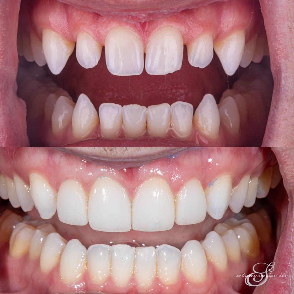 Skoulas DDS - The SF Cosmetic Dentist, photo 3