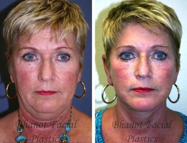 Bhanot Facial Plastic Surgery, photo 2