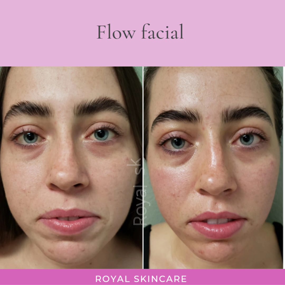 Royal Skincare, photo 2