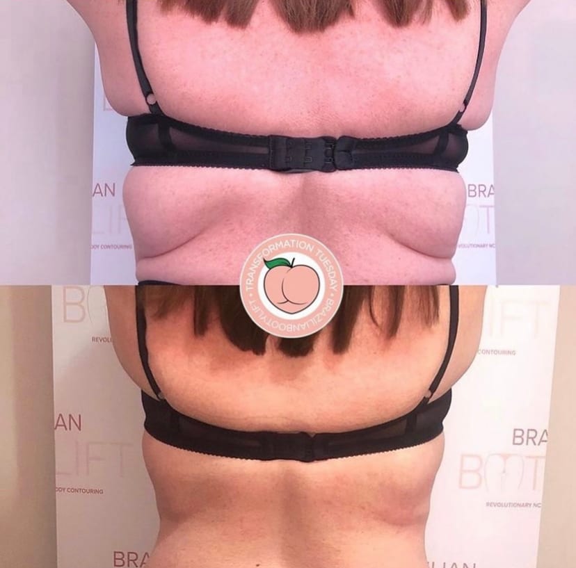 Body Sculpting Herts, photo 4