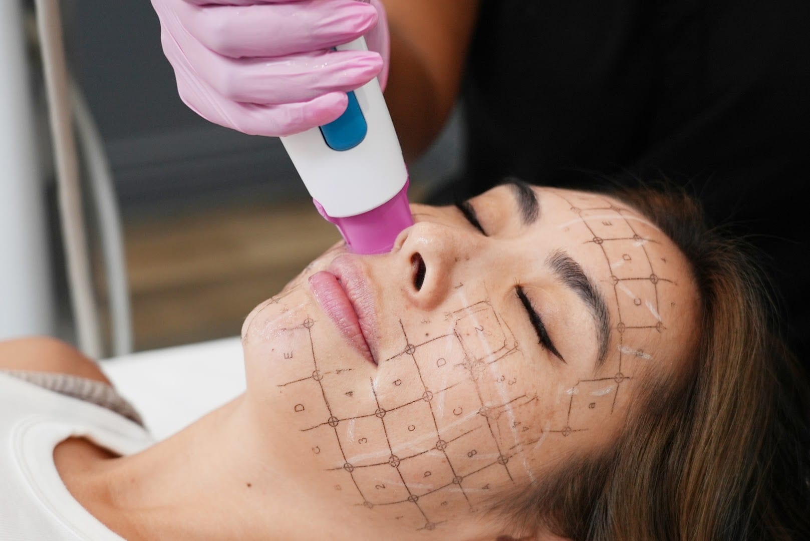 LaserAway Summerlin, photo 4