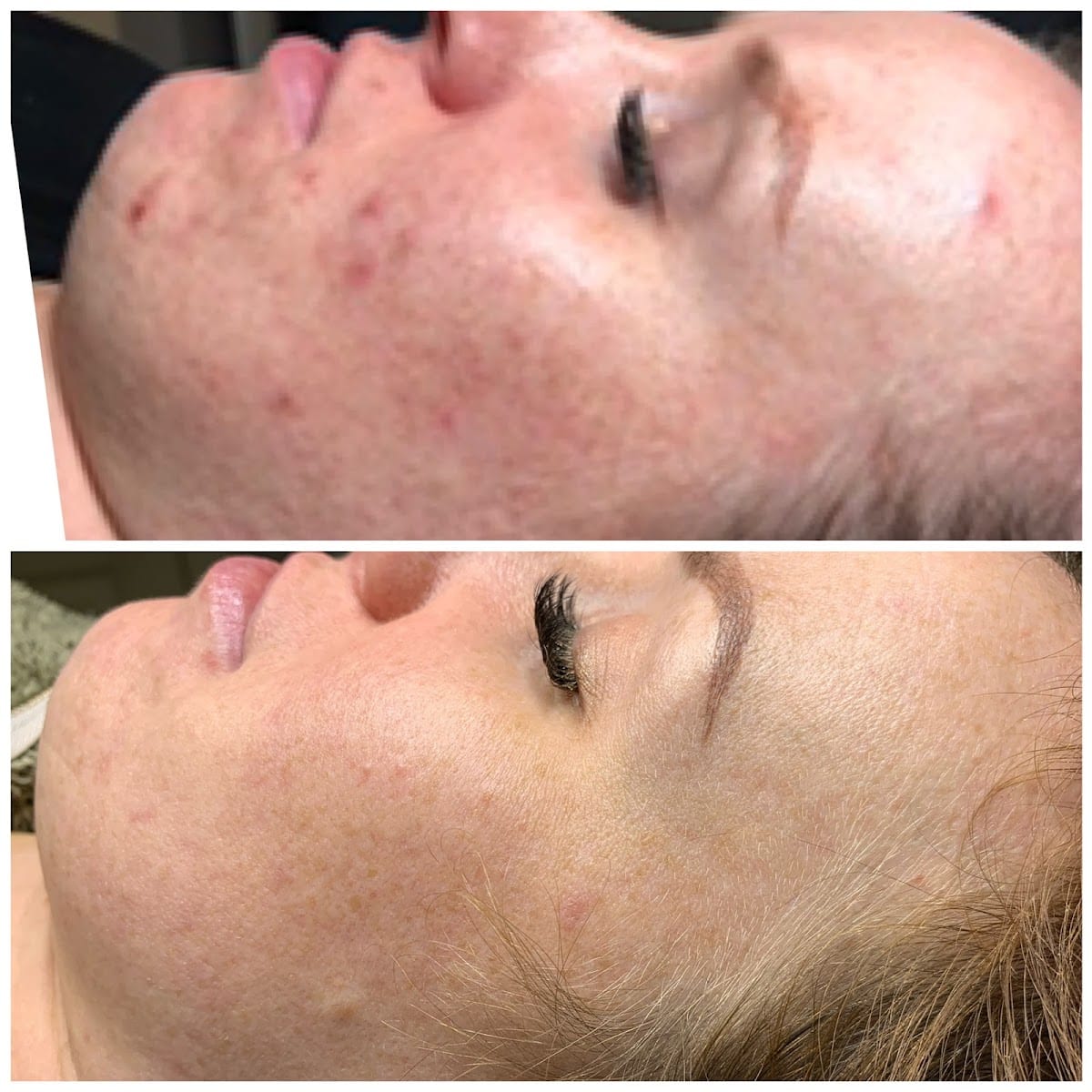 Skin Solutions Acne Clinic, photo 3