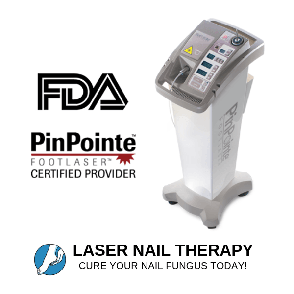 Laser Nail Therapy, photo 4