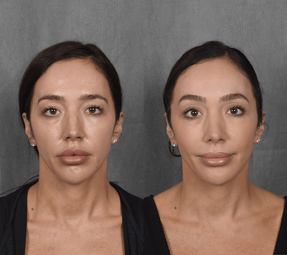 Vegas Facial Plastics - Mehdi Sina MD, MBA, photo 2