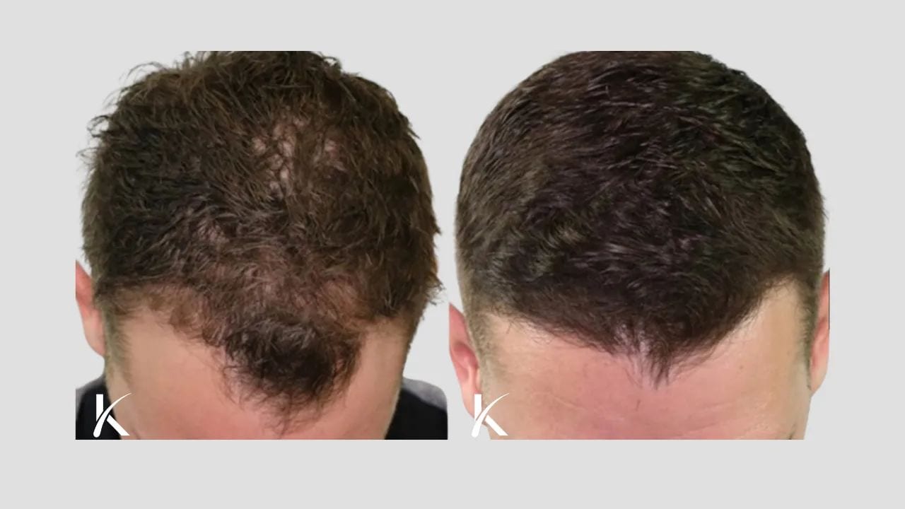 Kopelman Aesthetic Surgery