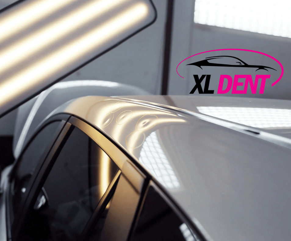 XL - Dent