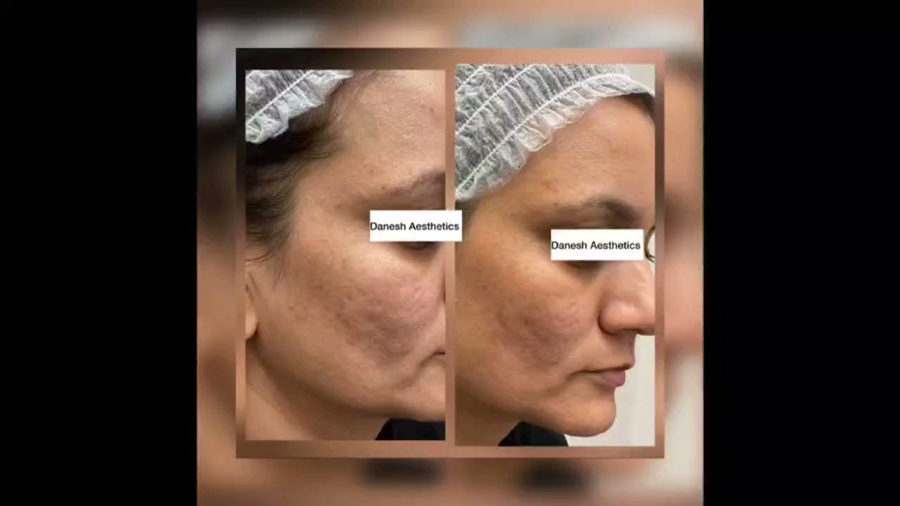 Danesh Aesthetics Dr.M.Danesh ND (Dermatology-Focused), photo 2