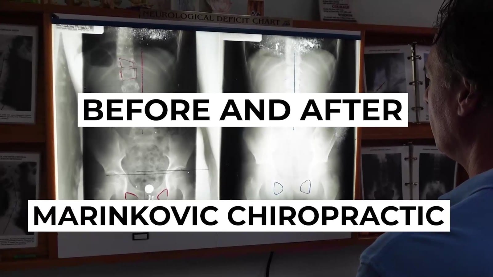 Marinkovic Chiropractic, photo 3