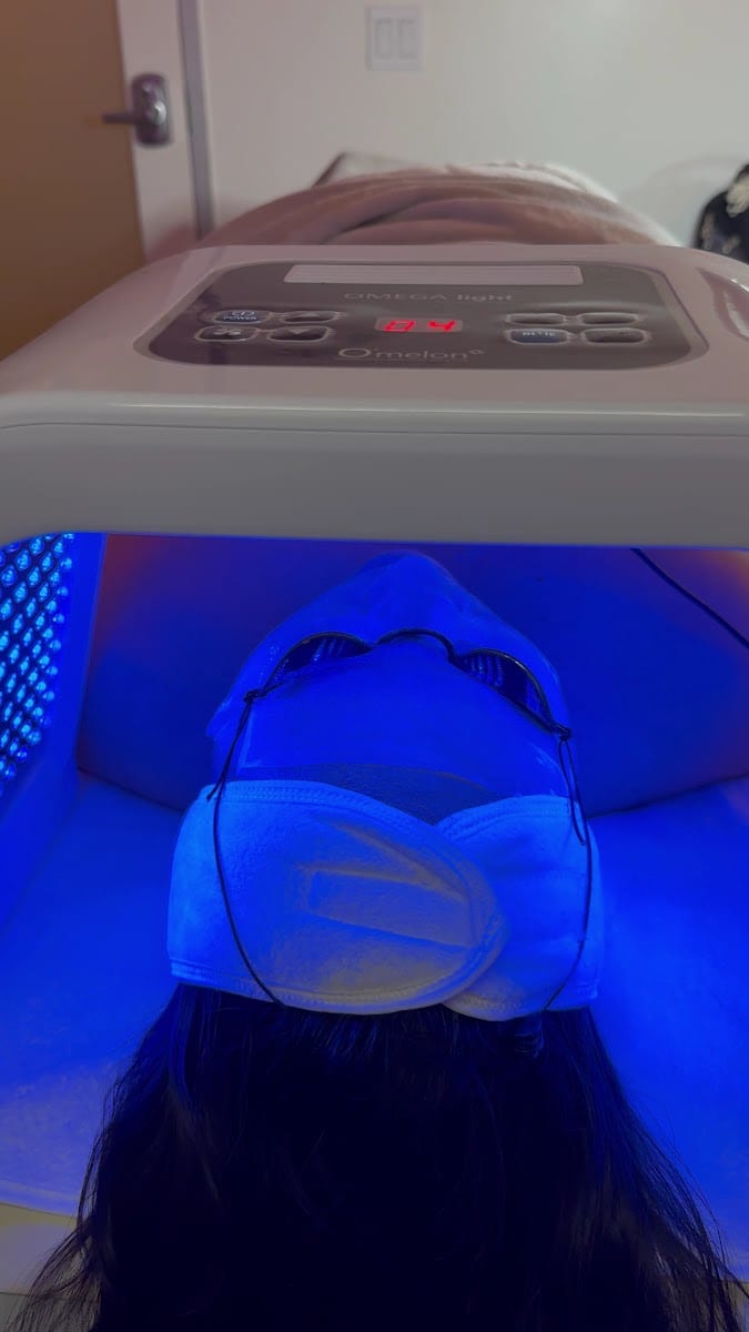 sora esthetics, photo 4