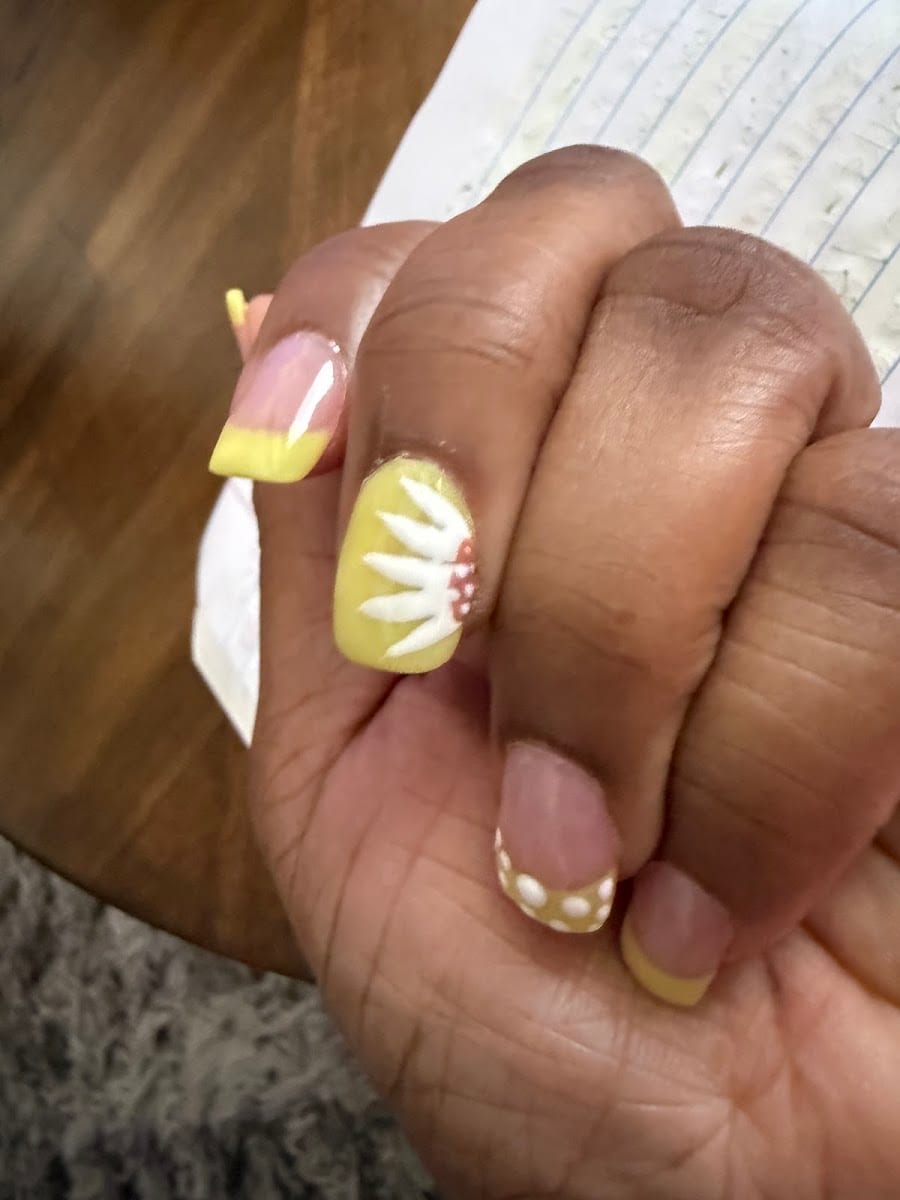 Thumb Nail, photo 2