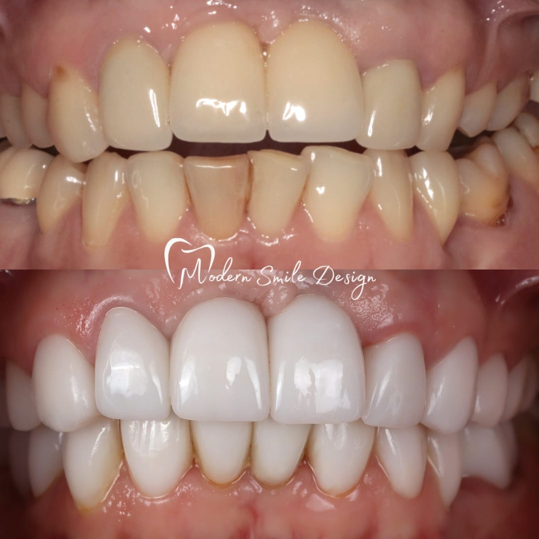 Modern Smile Design, photo 4