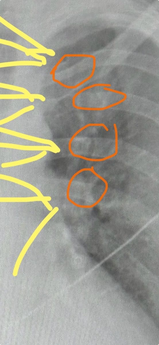 Ascension Sacred Heart Trauma and General Surgery Panama City, photo 4