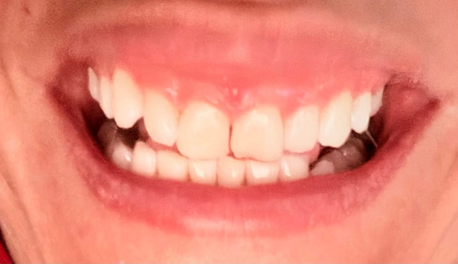 Perks Dental