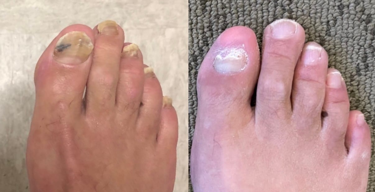 Bay Area Fungal Nail Clinic, photo 2