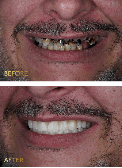 Eleve Dental Cosmetic & Implant Center