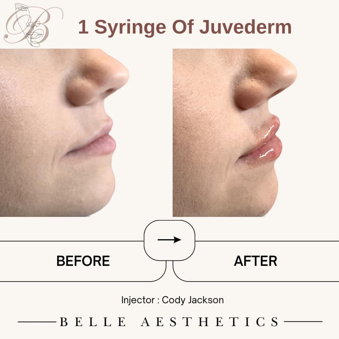 Belle MedSpa, photo 4