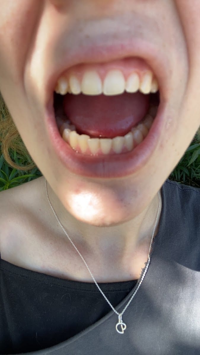 WALKERSTON DENTAL, photo 4