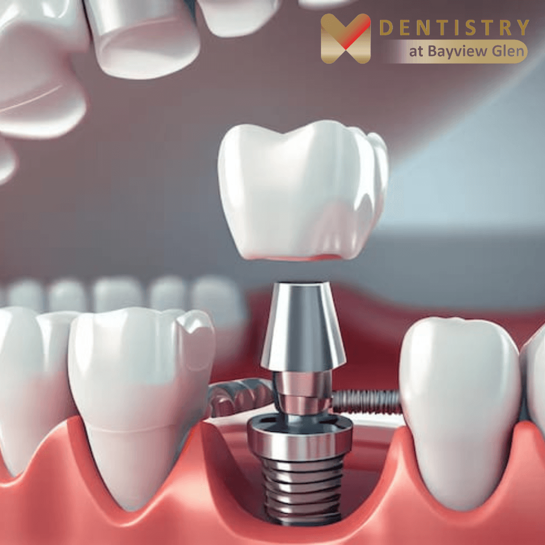 Dentistry At Bayview Glen, photo 4