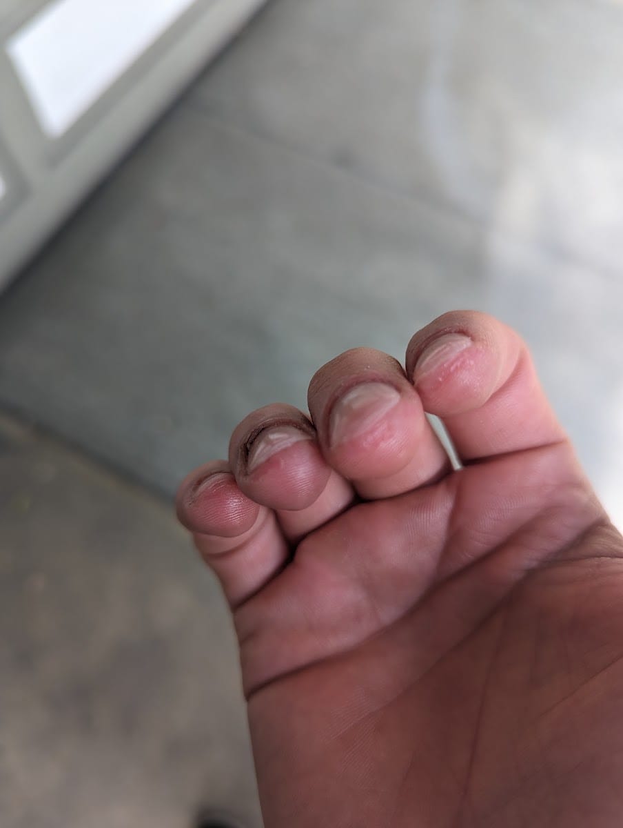 Healthy Nails, photo 3