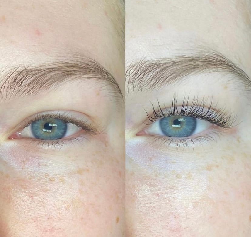Skin and Lashes, photo 3