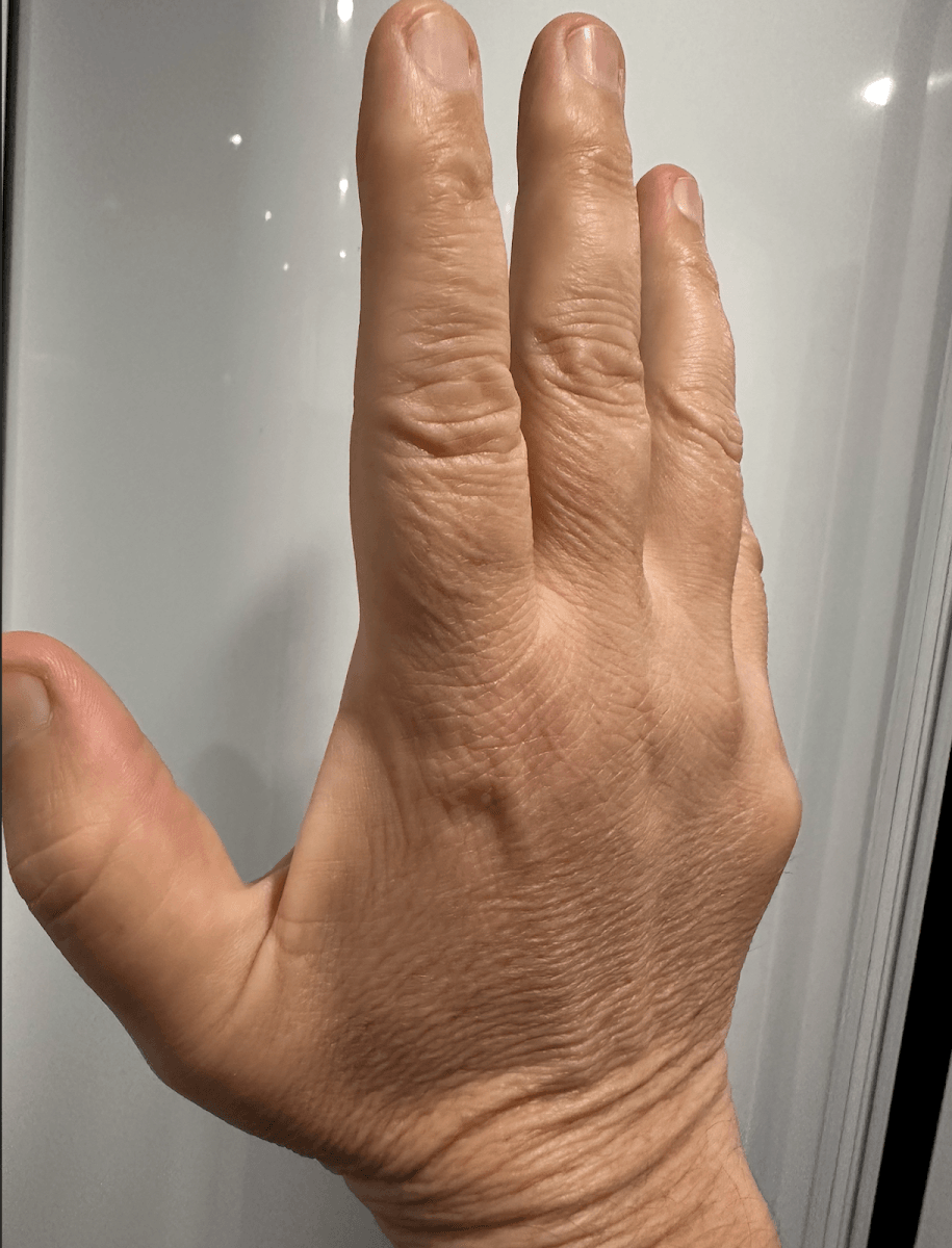 Dr. Erik Peterson, Orthopedic Hand Surgeon at Alpine Orthopedics