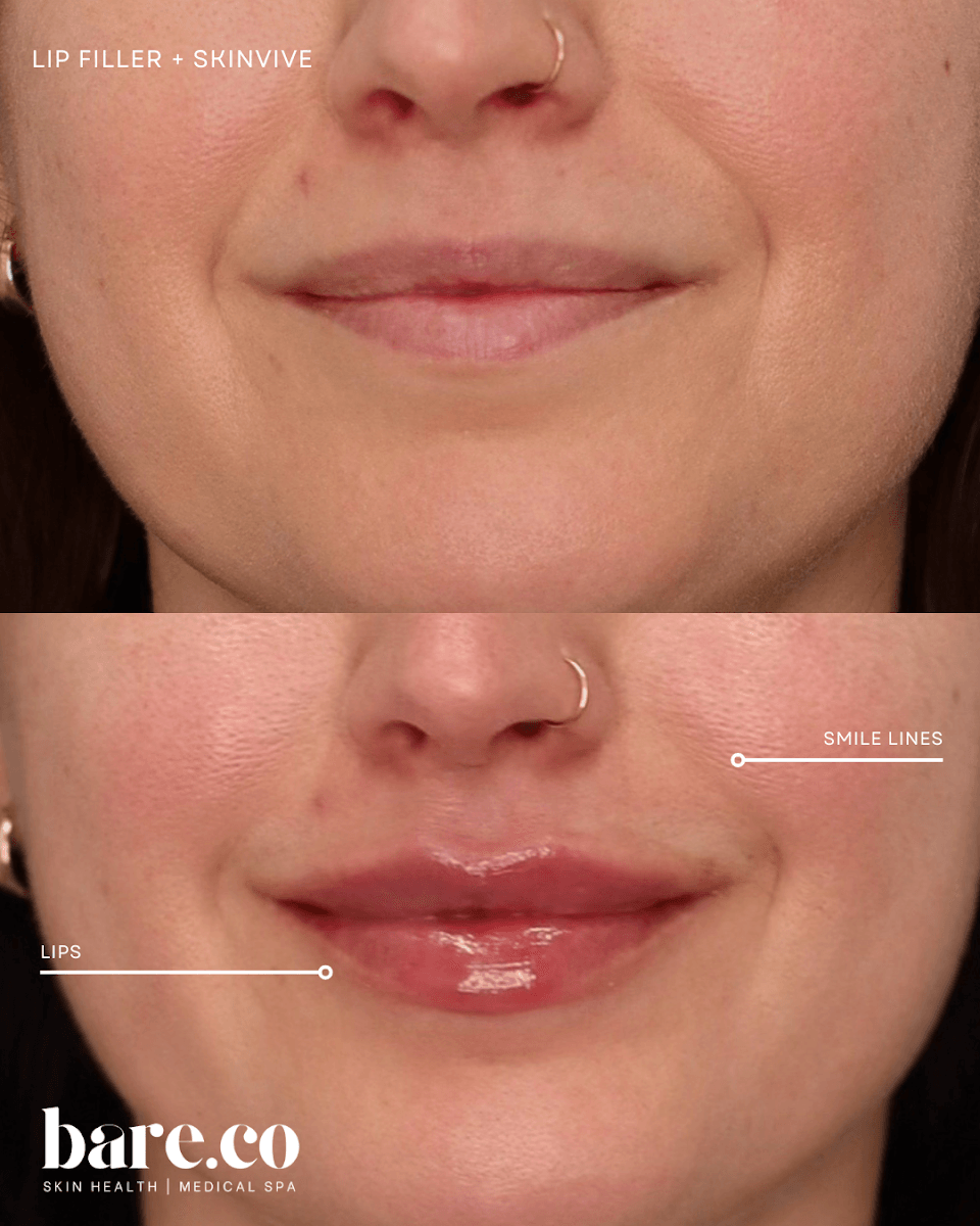 Bare.co Skin Health and Medical Spa, photo 4