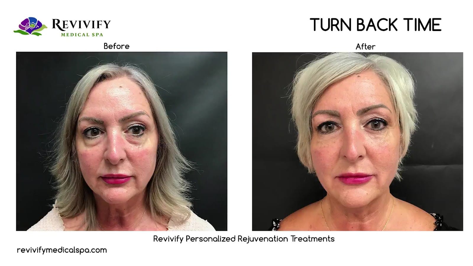 Revivify Medical Spa PLLC, photo 4