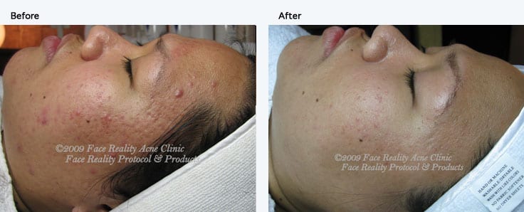 La Petite Rose Skincare & Acne Solution, photo 2