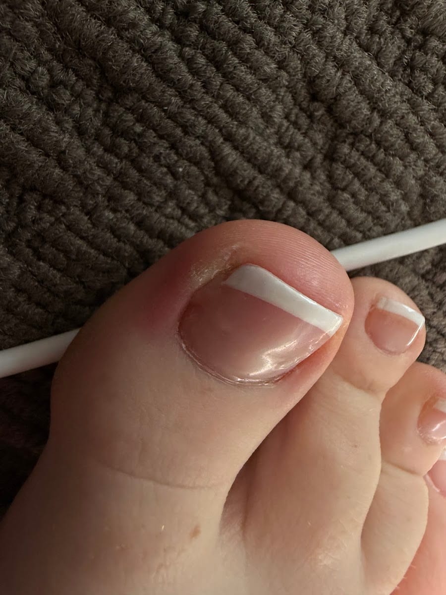 Q NAILS