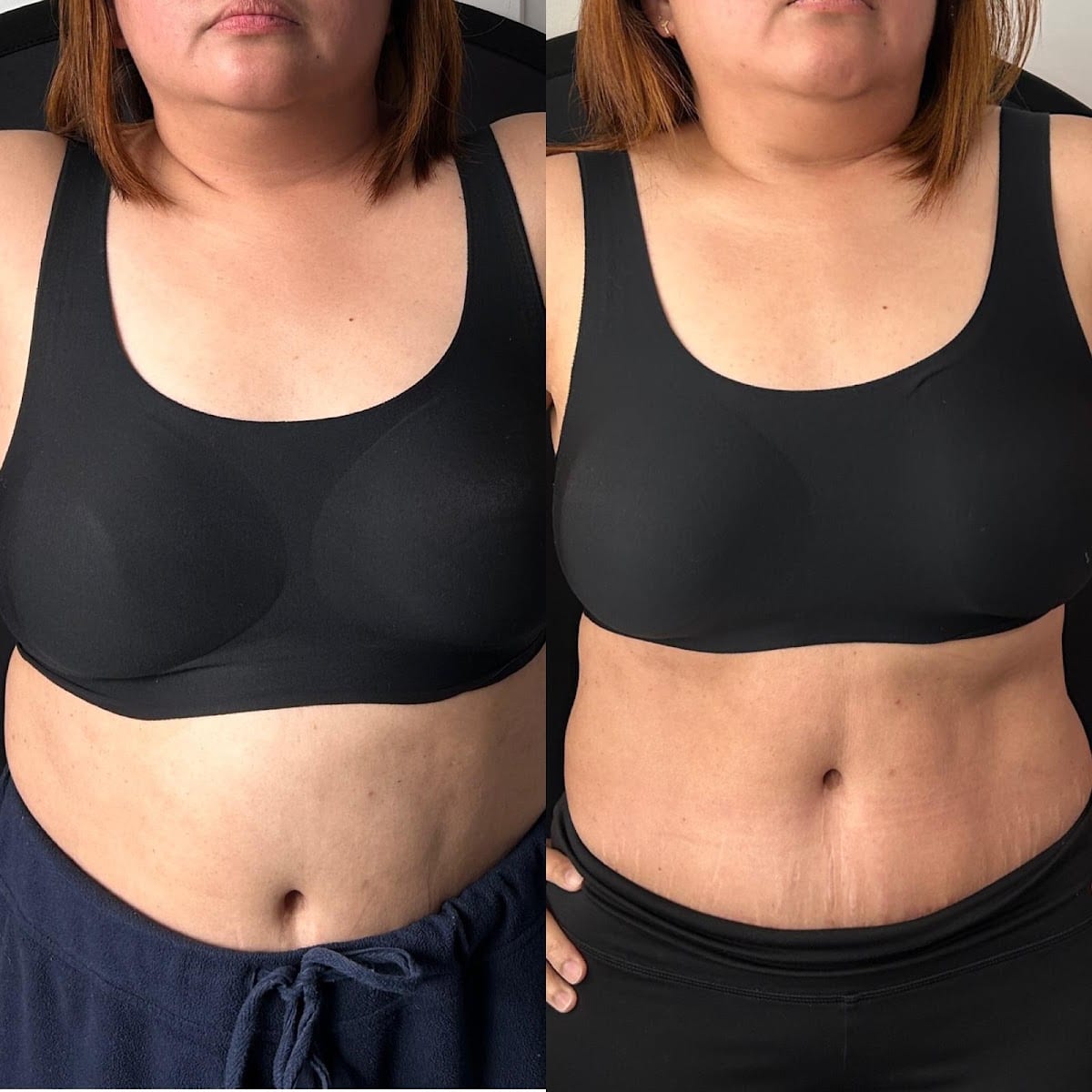 MyCryoHealth