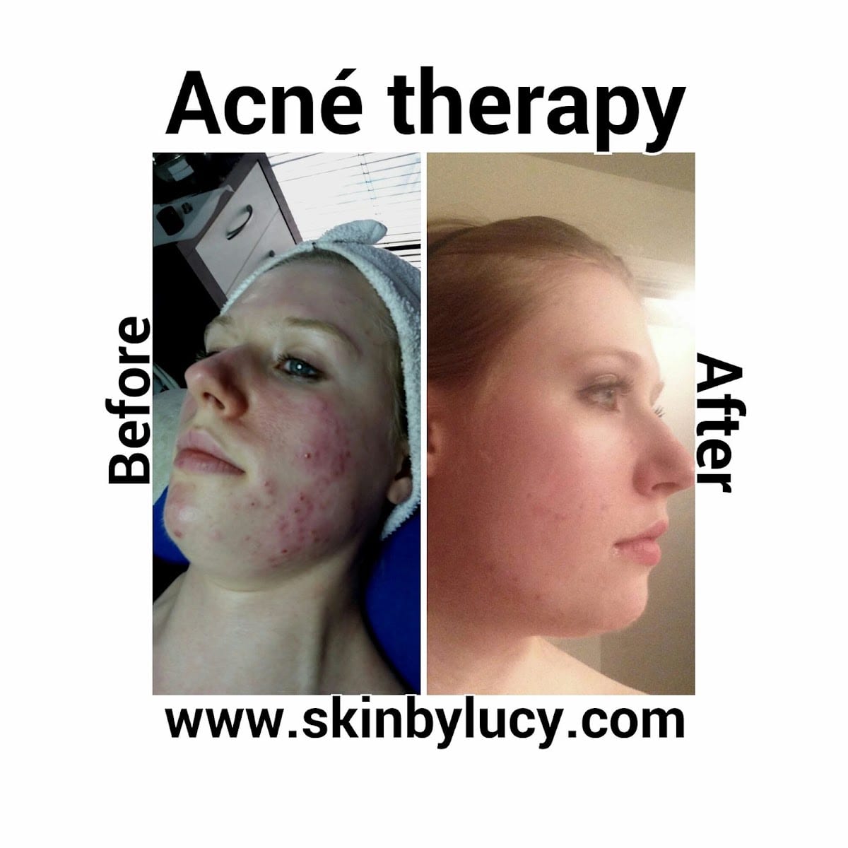 Skin By Lucy Med