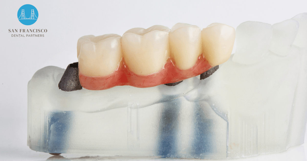 San Francisco Dental Partners | General, Cosmetic and Implant Dentistry, photo 4