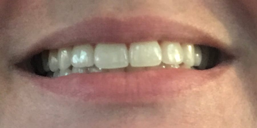 Marsh Orthodontics - William F Marsh DDS, photo 3
