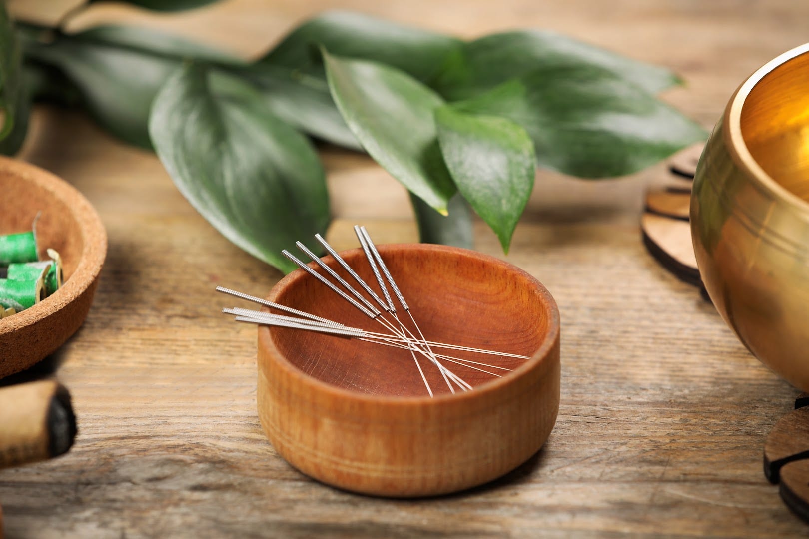 Creative Acupuncture, photo 2
