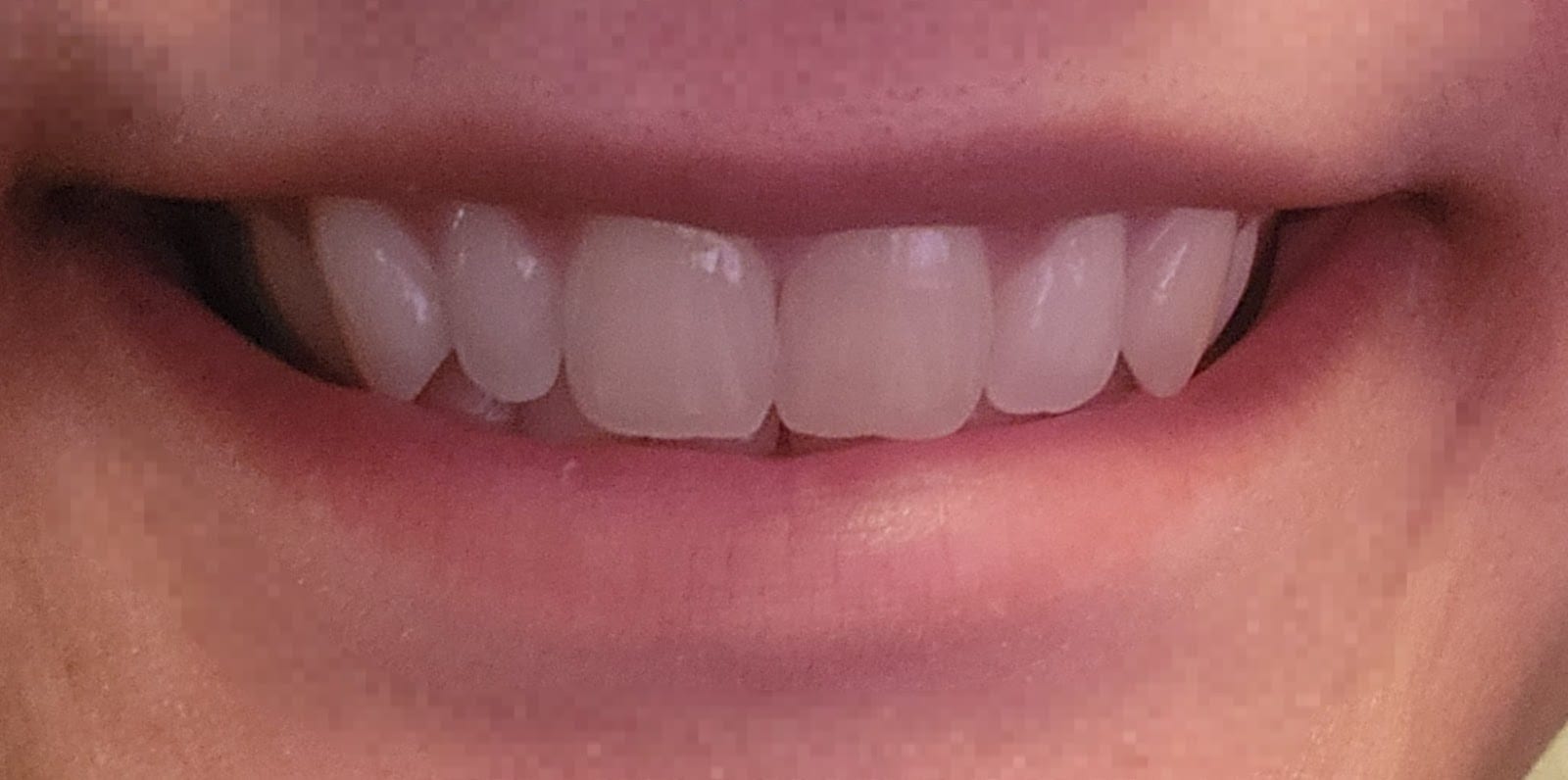East Avenue Dentistry PLLC: Harry Rosen DDS, photo 2