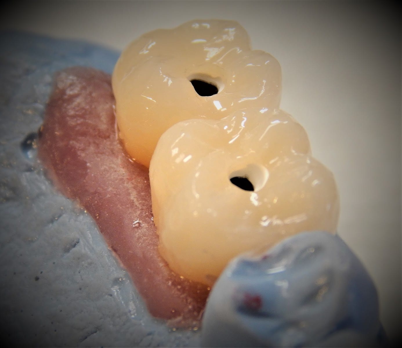 Pioneer Dental Studio Inc., photo 3