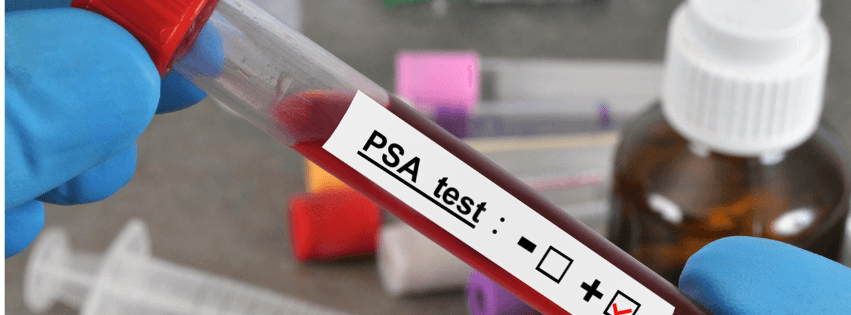 Free Prostate Screening In St Neots: Peterborough Guide