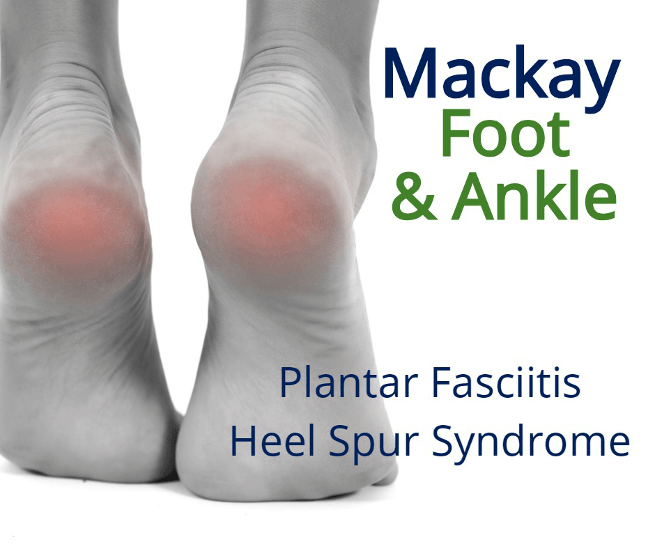 Mackay Foot & Ankle