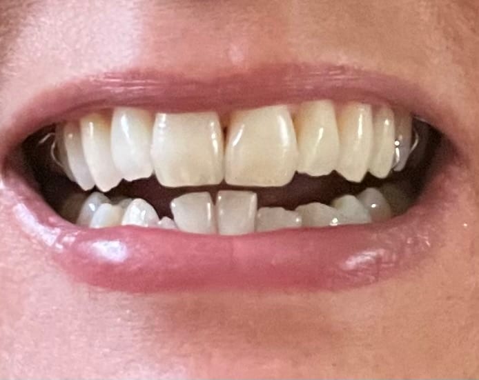 Timber Falls Family Dentistry