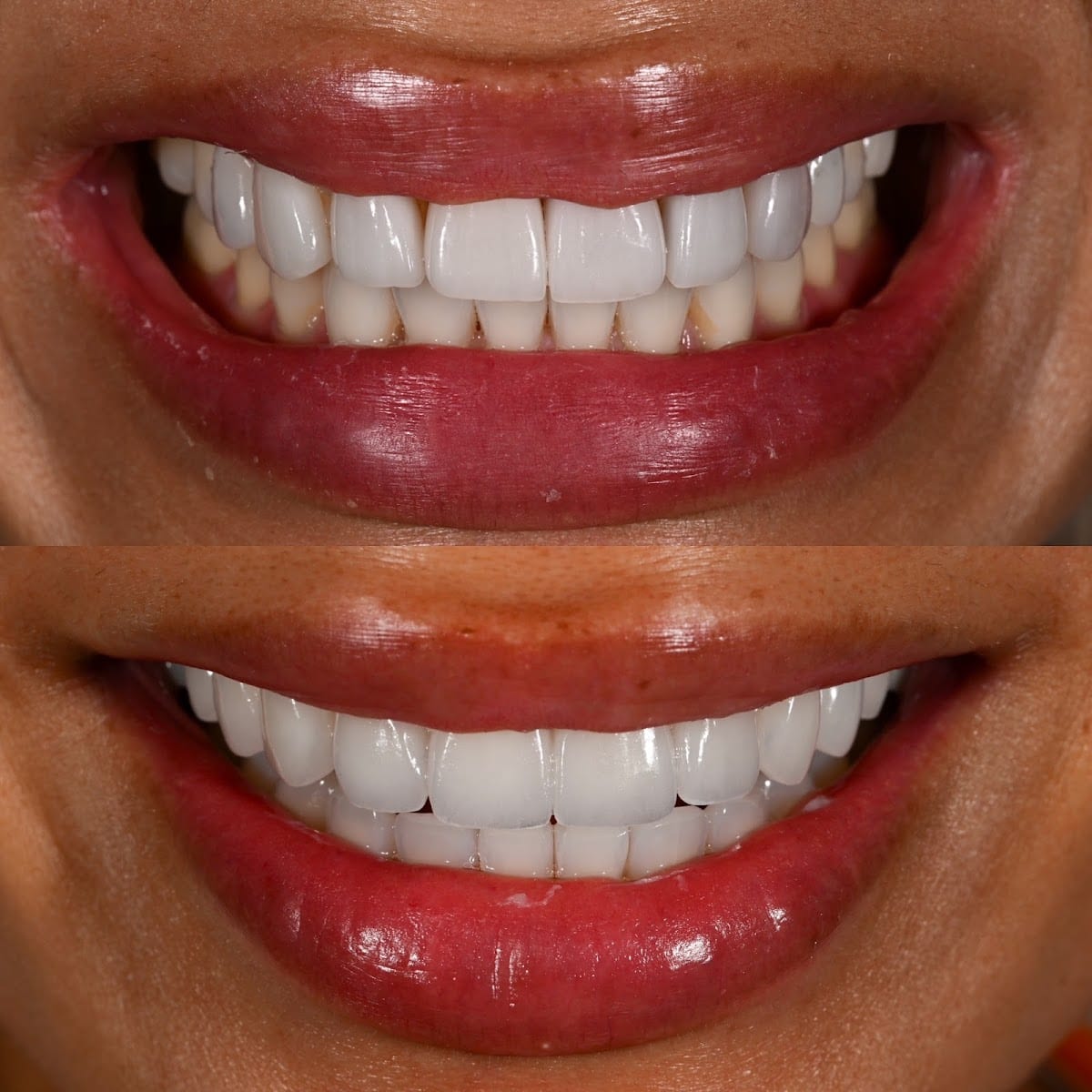 Olivia Moran, DDS | Veneers Dentist in San Francisco | ME Dental, photo 3