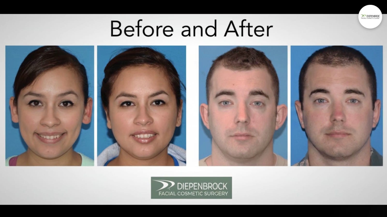 Diepenbrock Facial Cosmetic Surgery, photo 3