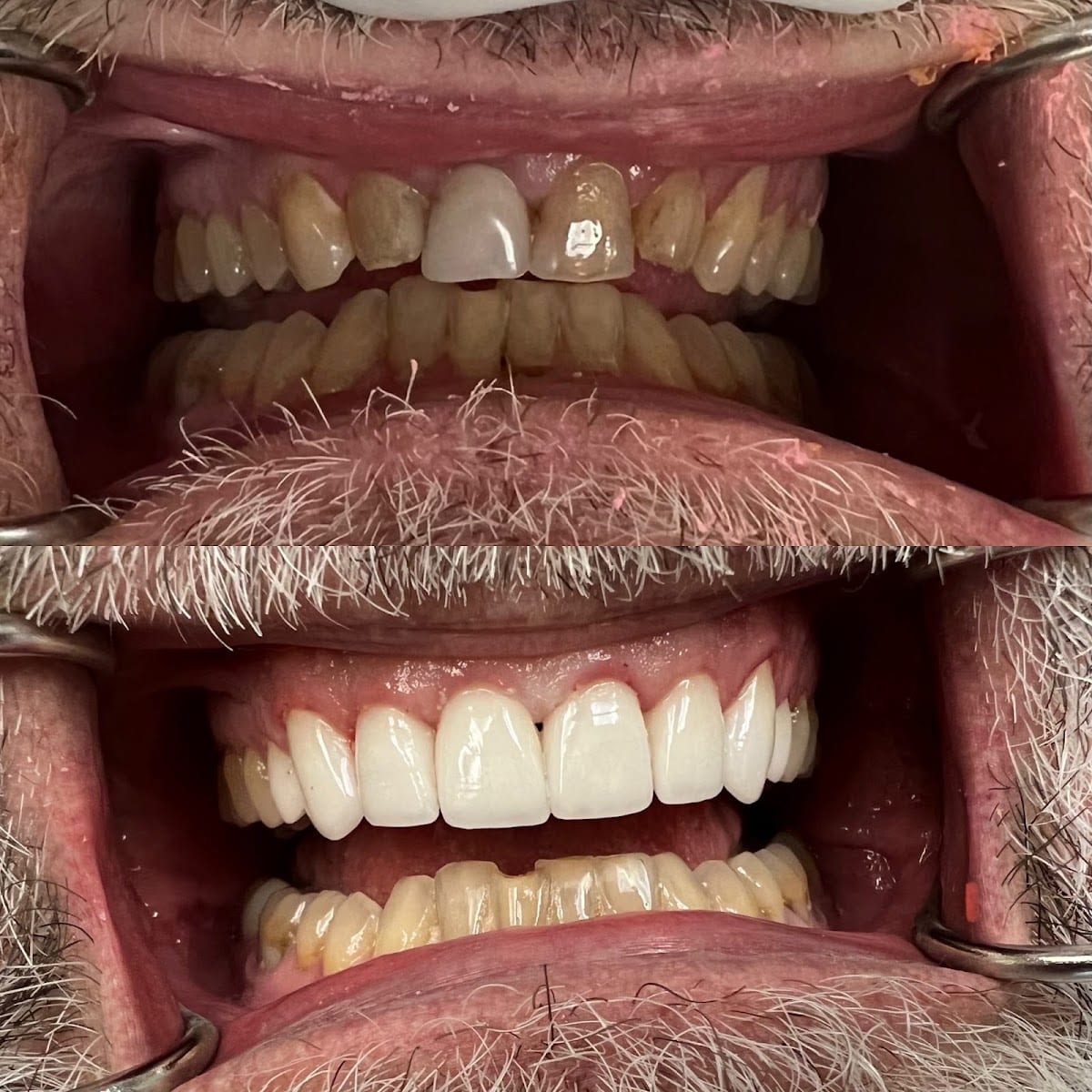 Platinum Dental of Logan, photo 4