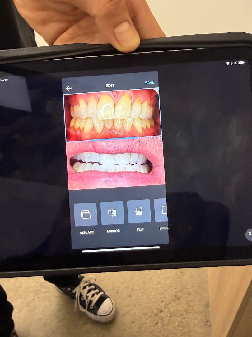 We Whiten Teeth Whitening, photo 4