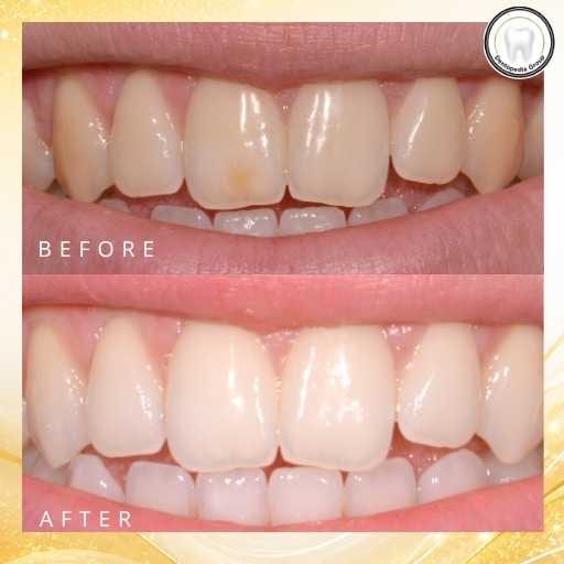 Redbourn Dentist (Dentopedia Group)