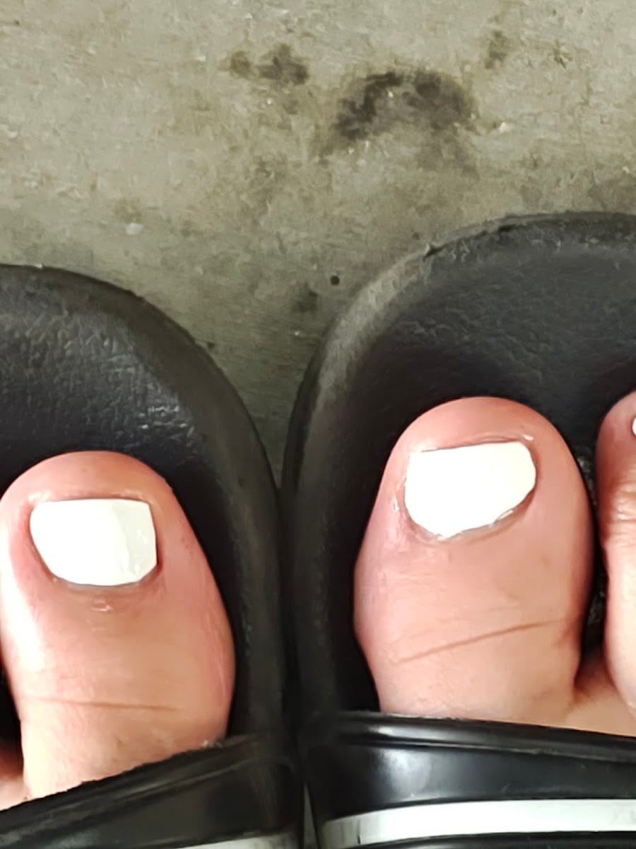 Hot Nail