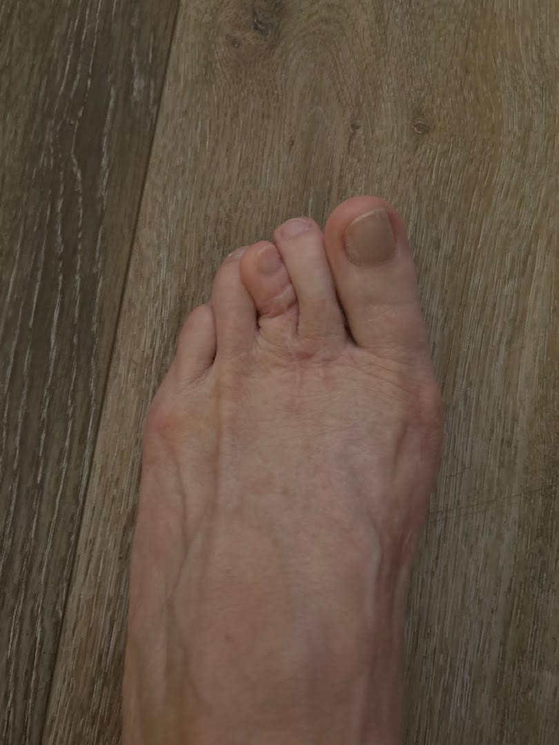 Foot and Ankle Centers of Charlotte County, photo 3